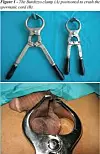 castration.jpeg
