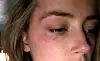 Amber Heard anklagar Johnny Depp för misshandel.